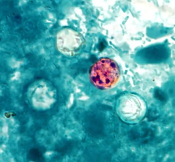 特朗普政府暂停环孢子虫研究 虽然疫情创纪录 图片